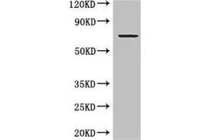 Western Blot Positive WB detected in: MCF-7 whole cell lysate All lanes: GRAMD4 antibody at 5 μg/mL Secondary Goat polyclonal to rabbit IgG at 1/50000 dilution Predicted band size: 67, 11 kDa Observed band size: 67 kDa (GRAMD4 antibody  (AA 23-161))