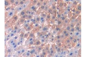 Detection of JAK2 in Rat Liver Tissue using Polyclonal Antibody to Janus Kinase 2 (JAK2) (JAK2 antibody  (AA 916-1103))