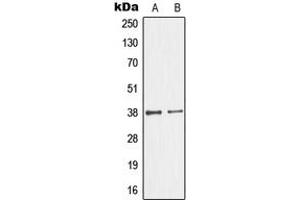 Western blot analysis of GIMAP4 expression in Jurkat (A), HeLa (B) whole cell lysates. (GIMAP4 antibody  (Center))