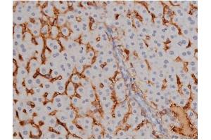 Immunohistochemistry (IHC) image for anti-Nucleophosmin (Nucleolar phosphoprotein B23, Numatrin) (NPM1) (pThr199) antibody (ABIN6256499)