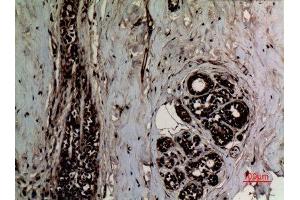 Immunohistochemistry (IHC) image for anti-Tumor Protein P53 (TP53) (2meLys370) antibody (ABIN3181859)