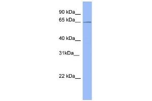 WB Suggested Anti-METTL3 Antibody Titration:  0.