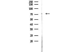 anti-Chromosome 18 Open Reading Frame 8 (C18orf8) (C-Term) antibody