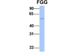 Host:  Rabbit  Target Name:  FGG  Sample Type:  Human Fetal Liver  Antibody Dilution:  1.