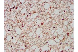 IHC image of ABIN7143995 diluted at 1:200 and staining in paraffin-embedded human brain tissue performed on a Leica BondTM system. (AIMP1 antibody  (AA 25-180))