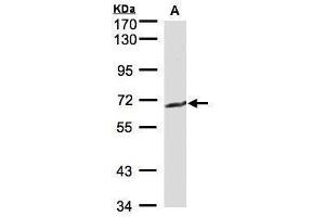 WB Image Sample(30 μg of whole cell lysate) A:MOLT4, 7. (GGT1 antibody)