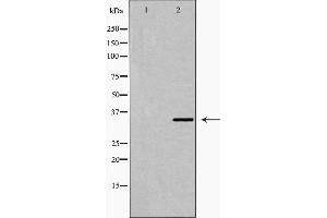 Western blot analysis of Fra 2 expression in LOVO cell extract. (FOSL2 antibody  (C-Term))