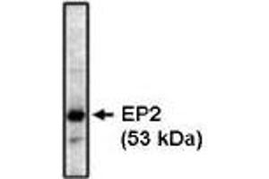 Western blot analysis using EP2 antibody on bovine brain lysate at 1 µg/ml. (PTGER2 antibody)