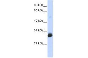 Image no. 1 for anti-Ring Finger Protein 186 (RNF186) (AA 107-156) antibody (ABIN6740809) (RNF186 antibody  (AA 107-156))