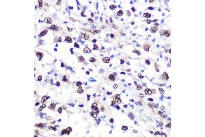 Immunohistochemistry (IHC) image for anti-Nucleolin (NCL) (AA 461-710) antibody (ABIN6144411)