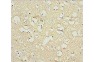Immunohistochemistry of paraffin-embedded human brain tissue using ABIN7161255 at dilution of 1:100 (NCALD antibody  (AA 1-193))