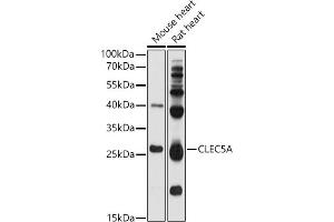 Western blot analysis of extracts of various cell lines, using CLEC5A antibody (ABIN1679280, ABIN1679281, ABIN5664169 and ABIN6219863) at 1:1000 dilution.