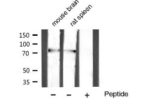 Western blot analysis of extracts of various celllines,using GRP78 Antibody (GRP78 antibody)