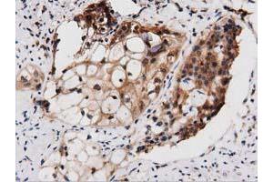 Immunohistochemical staining of paraffin-embedded Human Kidney tissue using anti-PEPD mouse monoclonal antibody.