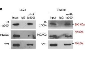 miR-500a-5p expression is up-regulated via the YY1/p300/HDAC2 complex. (HDAC2 antibody  (C-Term))