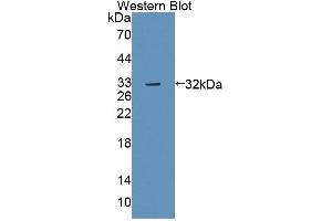 Detection of Recombinant PTPRB, Mouse using Polyclonal Antibody to Protein Tyrosine Phosphatase Receptor Type B (PTPRB) (PTPRB antibody  (AA 1214-1463))