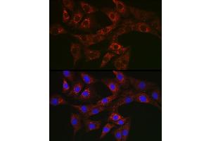 Immunofluorescence analysis of NIH/3T3 cells using A Rabbit pAb (ABIN3023408, ABIN3023409, ABIN3023410 and ABIN6219712) at dilution of 1:50 (40x lens).