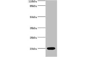 Western blot All lanes: NTS antibody at 2 μg/mL + Mouse small intestine tissue Secondary Goat polyclonal to rabbit IgG at 1/10000 dilution Predicted band size: 20 kDa Observed band size: 20 kDa (Neurotensin antibody  (AA 24-143))