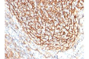 Immunohistochemistry (IHC) image for anti-Complement Component (3d/Epstein Barr Virus) Receptor 2 (CR2) (AA 142-240) antibody (ABIN6939184)