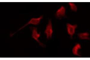 ABIN6276061 staining NIH-3T3 by IF/ICC. (NPY1R antibody  (Internal Region))