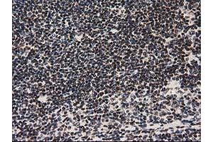 Image no. 7 for anti-Nonhomologous End-Joining Factor 1 (NHEJ1) antibody (ABIN1499729) (NHEJ1 antibody)