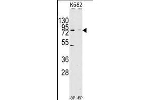 Western blot analysis of anti-JHDM1a/FBXL11 Antibody (C-term) (ABIN1536624 and ABIN2844141) pre-incubated with(right lane) and without(left lane) blocking peptide in Jurkat cell line lysate. (KDM2A antibody  (C-Term))