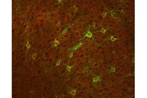 Immunohistochemistry (IHC) image for anti-Potassium Voltage-Gated Channel, Shaw-Related Subfamily, Member 1 (KCNC1) (AA 567-585) antibody (ABIN1742490)