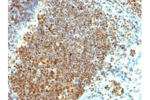 Image no. 2 for anti-Proliferating Cell Nuclear Antigen (PCNA) antibody (ABIN6166296) (PCNA antibody)