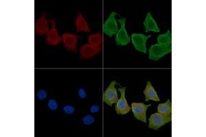 ABIN6260628 and ABIN6276794 staining Hela cells(30 min of UV treatment) by IF/ICC. (CD46 antibody  (N-Term))