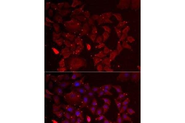 ADSS antibody