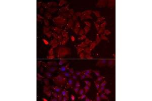 Immunofluorescence analysis of MCF7 cells using ADSS Polyclonal Antibody (ADSS antibody)