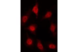ABIN6267419 staining HT29 by IF/ICC. (AFT1 antibody  (pSer63))
