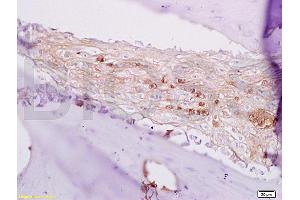 Formalin-fixed and paraffin embedded rabbit alveolar bone labeled with Anti-BMP7 Polyclonal Antibody, Unconjugated (ABIN678938) at 1:200 followed by conjugation to the secondary antibody and DAB staining. (BMP7 antibody  (AA 293-350))