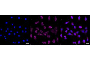 Immunocytochemical staining of Hela cells with Keratin 13 antibody (ABIN7799165), 1:1,000). (Recombinant Cytokeratin 13 antibody)