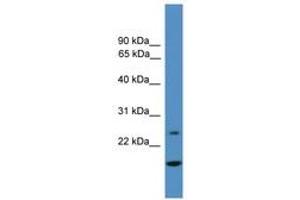 Image no. 1 for anti-Tissue Factor Pathway Inhibitor 2 (TFPI2) (AA 21-70) antibody (ABIN6745333) (TFPI2 antibody  (AA 21-70))
