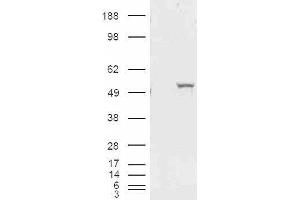 HEK293 overexpressing ALDH1A1 and probed with ABIN2561029 (mock transfection in first lane). (ALDH1A1 antibody  (Internal Region))
