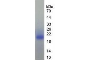 SDS-PAGE analysis of Human TGFb1I1 Protein. (TGFB1I1 Protein)