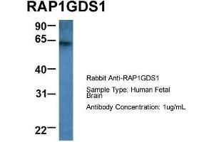 Host: Rabbit  Target Name: RAP1GDS1  Sample Tissue: Human Fetal Brain  Antibody Dilution: 1. (RAP1GDS1 antibody  (Middle Region))