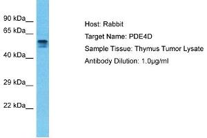 Host: Rabbit Target Name: PDE4D Sample Type: Thymus Tumor lysates Antibody Dilution: 1. (PDE4D antibody  (C-Term))