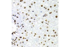Immunohistochemistry (Paraffin-embedded Sections) (IHC (p)) image for anti-Nuclear Factor of kappa Light Polypeptide Gene Enhancer in B-Cells 2 (NFKB2) (AA 690-899) antibody (ABIN3017388)