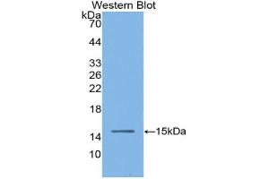 Western blot analysis of the recombinant protein. (Angiotensin I Converting Enzyme 1 antibody  (AA 334-409))