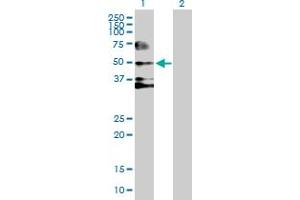 Western Blotting (WB) image for anti-serpin Peptidase Inhibitor, Clade D (Heparin Cofactor), Member 1 (SERPIND1) (AA 1-499) antibody (ABIN516364)