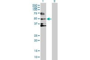 Western Blot analysis of SERPIND1 expression in transfected 293T cell line by SERPIND1 MaxPab polyclonal antibody. (SERPIND1 antibody  (AA 1-499))