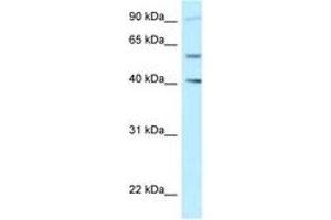 Image no. 1 for anti-SHC SH2-Domain Binding Protein 1-Like (SHCBP1L) (AA 525-574) antibody (ABIN6747880) (SHCBP1L antibody  (AA 525-574))