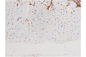 ABIN6267528 at 1/200 staining Mouse heart tissue sections by IHC-P. (SAPK, JNK (pThr183) antibody)