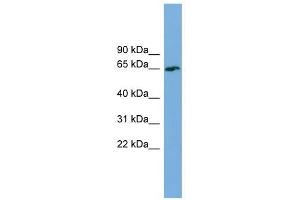 TBC1D24 antibody used at 1 ug/ml to detect target protein. (TBC1D24 antibody  (Middle Region))