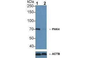 Western blot analysis of (1) Wild-type HeLa cell lysate, and (2) PAK4 knockout HeLa cell lysate, using Rabbit Anti-Human PAK4 Antibody (1 µg/ml) and HRP-conjugated Goat Anti-Rabbit antibody (abx400043, 0. (PAK4 antibody  (AA 299-542))