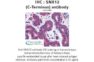 Image no. 2 for anti-Sorting Nexin 12 (SNX12) (C-Term) antibody (ABIN1739487) (SNX12 antibody  (C-Term))