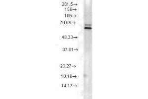 Hsp70 (5A5), rat lysate (HSP70 antibody)