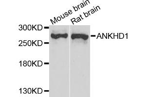 Western blot analysis of extracts of various cell lines, using ANKHD1 antibody. (ANKHD1 antibody)